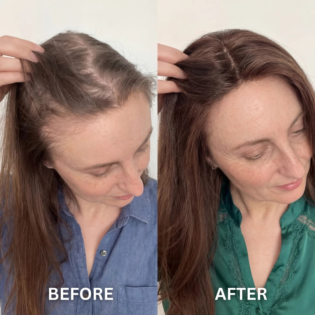 FoligenX™ Hair Helper Serum by tryAuraé