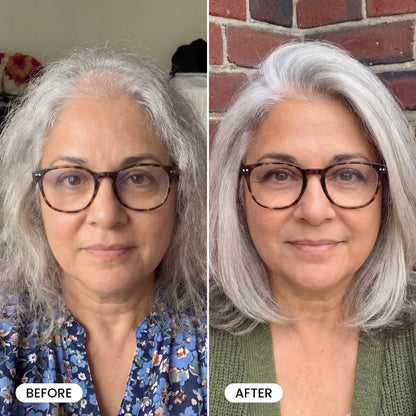 FoligenX™ Hair Helper Serum by tryAuraé