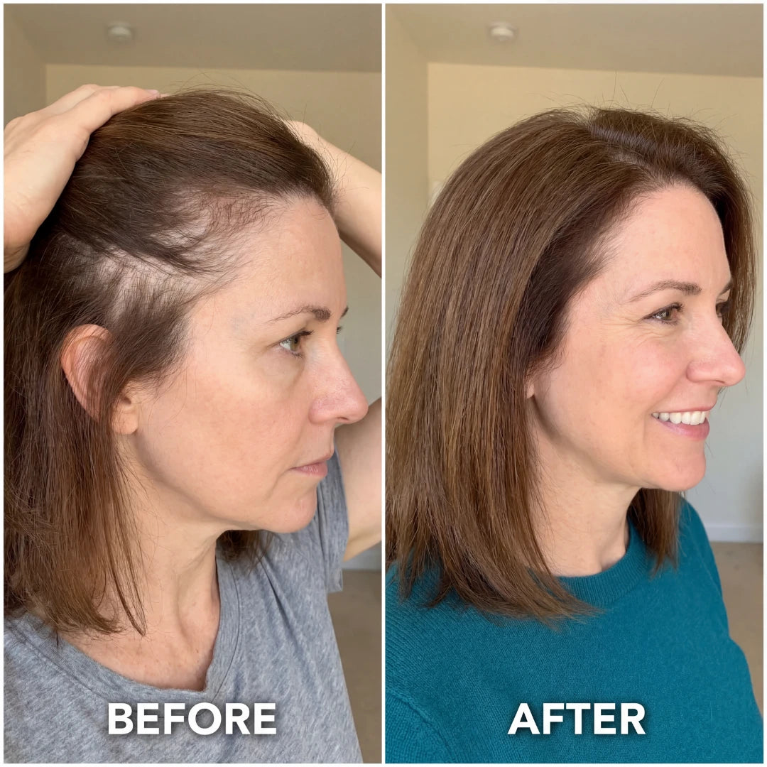 FoligenX™ Hair Helper Serum by tryAuraé