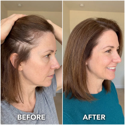 FoligenX™ Hair Helper Serum by tryAuraé